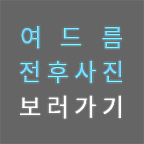 여드름 전후사진 보러가기